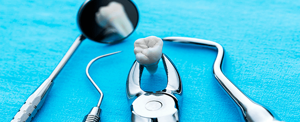 Удаление зубов в Калуге